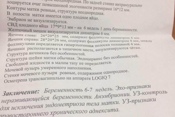 Восстановить аккаунт на кракене